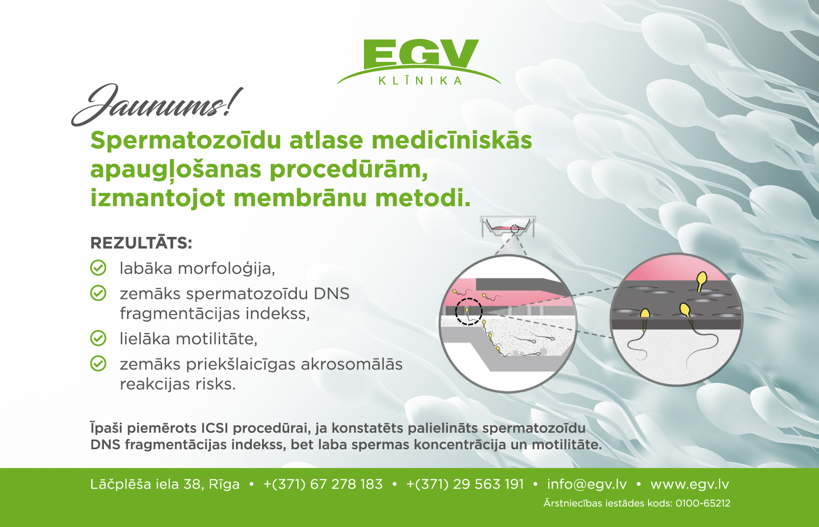 Kas ir spermatozoīdu atlase, izmantojot membrānu metodi?